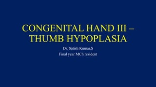 CONGENITAL HAND III –
THUMB HYPOPLASIA
Dr. Satish Kumar.S
Final year MCh resident
 