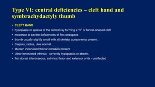 Thumb hypoplasia - congenital hand III | PPTX
