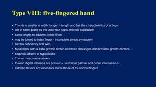 Thumb hypoplasia - congenital hand III | PPTX