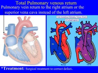 Total Pulmonary venous return
Pulmonary vein return to the right atrium or the
superior vena cava instead of the left atrium.
*Treatment: Surgical treatment to correct defect.
 
