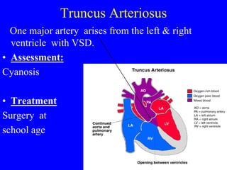 Truncus Arteriosus
One major artery arises from the left & right
ventricle with VSD.
• Assessment:
Cyanosis
• Treatment
Surgery at
school age
 