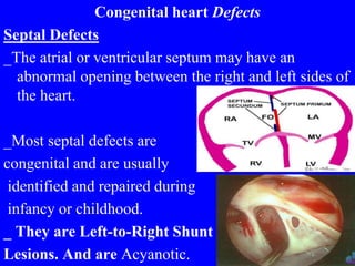 Congenital heart Defects
Septal Defects
_The atrial or ventricular septum may have an
abnormal opening between the right and left sides of
the heart.
_Most septal defects are
congenital and are usually
identified and repaired during
infancy or childhood.
_ They are Left-to-Right Shunt
Lesions. And are Acyanotic.
 