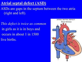 Atrial septal defect (ASD)
ASDs are gaps in the septum between the two atria
(right and left).
This defect is twice as common
in girls as it is in boys and
occurs in about 1 in 1500
live births.
 
