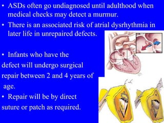 • ASDs often go undiagnosed until adulthood when
medical checks may detect a murmur.
• There is an associated risk of atrial dysrhythmia in
later life in unrepaired defects.
• Infants who have the
defect will undergo surgical
repair between 2 and 4 years of
age.
• Repair will be by direct
suture or patch as required.
 