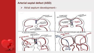Congenital heart diseases | PPTX