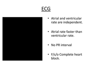 ECG
• Atrial and ventricular
rate are independent.
• Atrial rate faster than
ventricular rate.
• No PR interval
• F/s/o Complete heart
block.
 