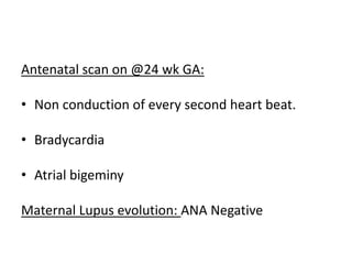 Antenatal scan on @24 wk GA:
• Non conduction of every second heart beat.
• Bradycardia
• Atrial bigeminy
Maternal Lupus evolution: ANA Negative
 