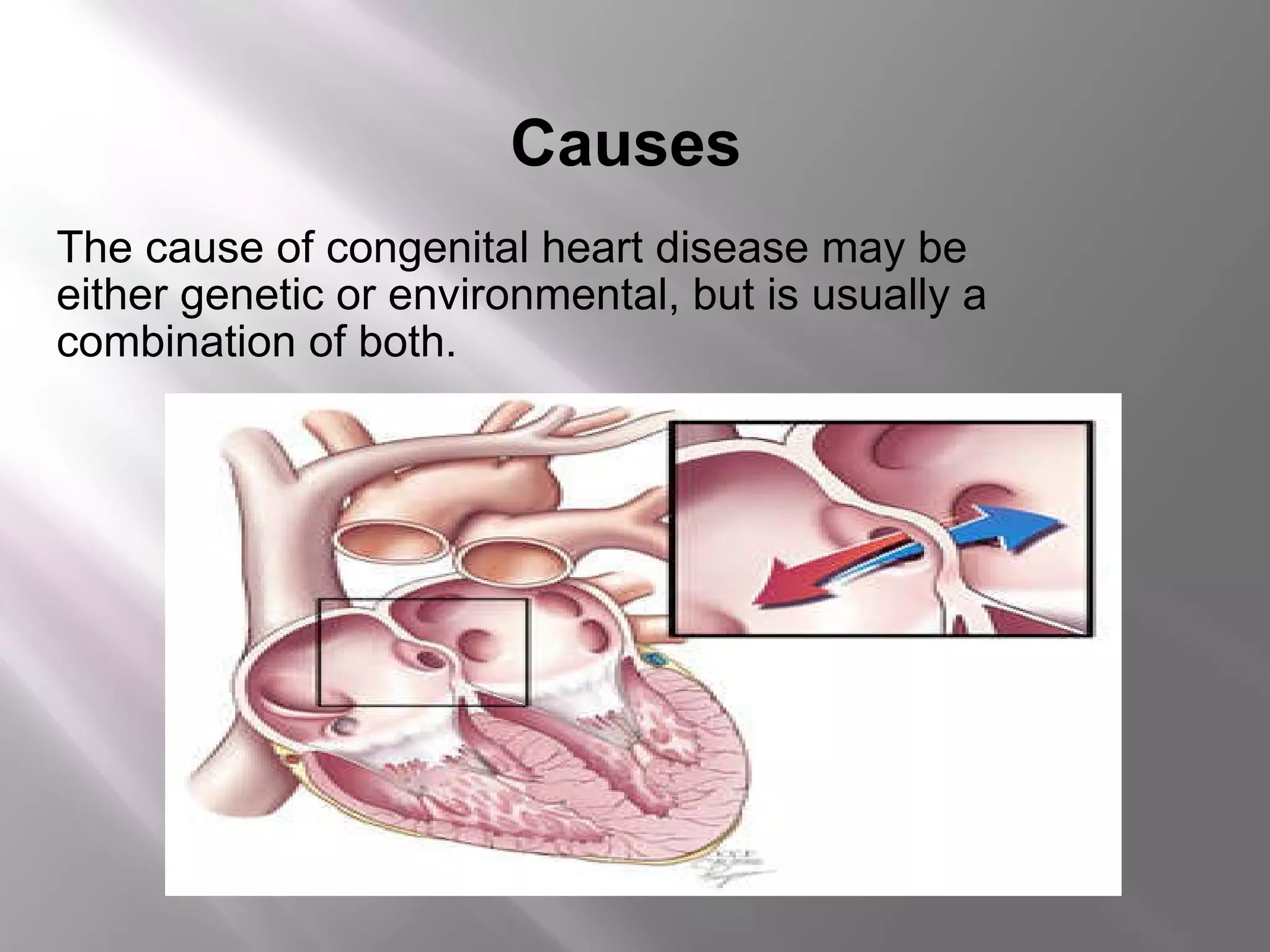 Congenital heart defects | PPT