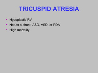 TRICUSPID ATRESIA
• Hypoplastic RV
• Needs a shunt, ASD, VSD, or PDA
• High mortality
 