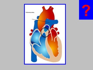 Pulmonary artery
?
 