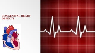 CONGENITAL HEART
DEFECTS
 