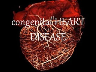 congenital HEART
DISEASE
 