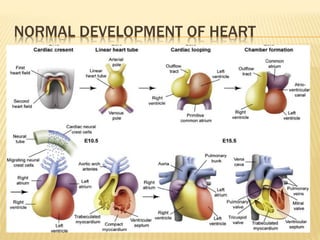 Congenital heart disease | PPTX