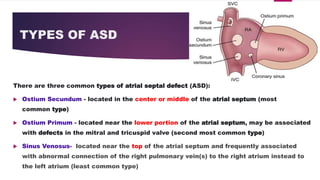 Congenital heart disease | PPTX