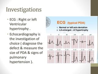 Investigations
• ECG : Right or left
Ventricular
hypertrophy .
• Echocardiography is
the investigation of
choice ( diagnose the
defect & measure the
size of PDA & signs of
pulmonary
hypertension ).
 