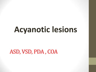 ASD, VSD, PDA , COA
Acyanotic lesions
 