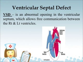Ventricular Septal Defect
VSD – is an abnormal opening in the ventricular
septum, which allows free communication between
the Rt & Lt ventricles.
 