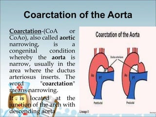 Coarctation of the Aorta
Coarctation-(CoA or
CoAo), also called aortic
narrowing, is a
congenital condition
whereby the aorta is
narrow, usually in the
area where the ductus
arteriosus inserts. The
word "coarctation"
means narrowing.
It is located at the
junction of the arch with
descending aorta
 