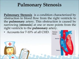 Pulmonary Stenosis
Pulmonary Stenosis is a condition characterized by
obstruction to blood flow from the right ventricle to
the pulmonary artery. This obstruction is caused by
narrowing (stenosis) at one or more points from the
right ventricle to the pulmonary artery.
• Accounts for 7-10% of all CHD.
 