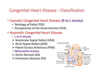 Congenital Heart Disease - Classification
• Cyanotic Congenital Heart Disease (R to L shunts)
• Tetralogy of Fallot (TOF)
• Transposition of the Great Arteries (TGA)
• Acyanotic Congenital Heart Disease
• L to R shunts
 Ventricular Septal Defect (VSD)
 Atrial Septal Defect (ASD)
 Patent Ductus Arteriosus (PDA)
• Obstructive lesions
 Aortic Stenosis (AS)
 Pulmonary Stenosis (PS)
 