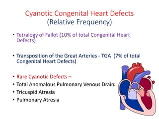 Cyanotic Congenital Heart Defects
(Relative Frequency)
• Tetralogy of Fallot (10% of total Congenital Heart
Defects)
• Transposition of the Great Arteries - TGA (7% of total
Congenital Heart Defects)
• Rare Cyanotic Defects –
• Total Anomalous Pulmonary Venous Drainage
• Tricuspid Atresia
• Pulmonary Atresia
 