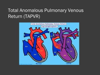Congenital heart disease | PPT