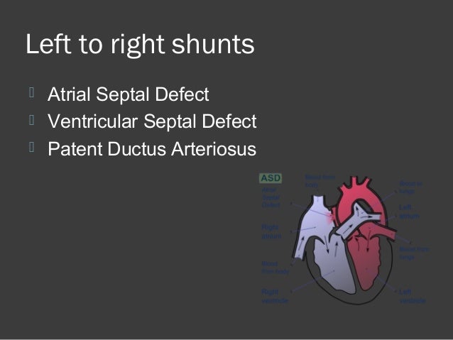 Atrial septal defect left to right shunt
