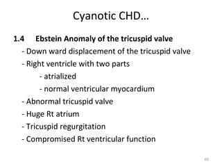 Cyanotic CHD…
1.4 Ebstein Anomaly of the tricuspid valve
  - Down ward displacement of the tricuspid valve
  - Right ventricle with two parts
        - atrialized
        - normal ventricular myocardium
  - Abnormal tricuspid valve
  - Huge Rt atrium
  - Tricuspid regurgitation
  - Compromised Rt ventricular function

                                                    65
 