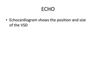 ECHO
• Echocardiogram shows the position and size
of the VSD
 