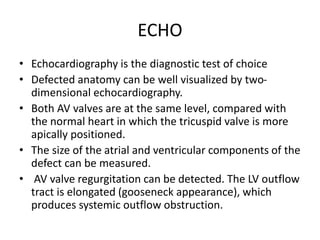 ECHO
• Echocardiography is the diagnostic test of choice
• Defected anatomy can be well visualized by two-
dimensional echocardiography.
• Both AV valves are at the same level, compared with
the normal heart in which the tricuspid valve is more
apically positioned.
• The size of the atrial and ventricular components of the
defect can be measured.
• AV valve regurgitation can be detected. The LV outflow
tract is elongated (gooseneck appearance), which
produces systemic outflow obstruction.
 