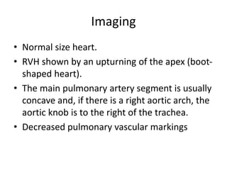 Imaging
• Normal size heart.
• RVH shown by an upturning of the apex (boot-
shaped heart).
• The main pulmonary artery segment is usually
concave and, if there is a right aortic arch, the
aortic knob is to the right of the trachea.
• Decreased pulmonary vascular markings
 