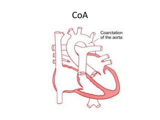 CoA
 