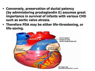  Conversely, preservation of ductal patency
(by administering prostaglandin E) assumes great
importance in survival of infants with various CHD
such as aortic valve atresia.
 Therefore PDA may be either life-threatening, or
life-saving.
 