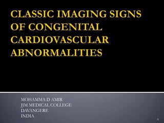 CLASSIC IMAGING SIGNS OF CONGENITAL CARDIOVASCULAR ABNORMALITIES MOHAMMA D AMIR JJM MEDICAL COLLEGE DAVANGERE INDIA 1 