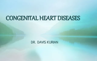 CONGENITAL HEART DISEASES
DR. DAVIS KURIAN
 