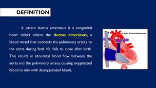 DEFINITION
A patent ductus arteriosus is a congenital
heart defect where the ductus arteriosus, a
blood vessel that connects the pulmonary artery to
the aorta during fetal life, fails to close after birth.
This results in abnormal blood flow between the
aorta and the pulmonary artery, causing oxygenated
blood to mix with deoxygenated blood.
 
