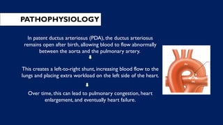 PATHOPHYSIOLOGY
In patent ductus arteriosus (PDA), the ductus arteriosus
remains open after birth, allowing blood to flow abnormally
between the aorta and the pulmonary artery.
This creates a left-to-right shunt, increasing blood flow to the
lungs and placing extra workload on the left side of the heart.
Over time, this can lead to pulmonary congestion, heart
enlargement, and eventually heart failure.
 