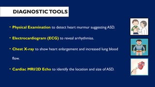 DIAGNOSTICTOOLS
• Physical Examination to detect heart murmur suggesting ASD.
• Electrocardiogram (ECG) to reveal arrhythmias.
• Chest X-ray to show heart enlargement and increased lung blood
flow.
• Cardiac MRI/2D Echo to identify the location and size of ASD.
 