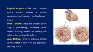 Surgical Approach: The most common
surgical method involves a median
sternotomy and requires cardiopulmonary
bypass.
Small Defects: These are typically closed
using a purse-string technique, which
involves stitching around the opening and
pulling it tight to close the defect.
Large Defects: For larger defects, a knitted
Dacron patch is sewn over the opening to
effectively seal it.
 