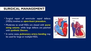 • Surgical repair of ventricular septal defects
(VSDs) involves an open-heart procedure.
• Moderate to small VSDs are closed with purse
string sutures, while large defects are patched
with synthetic Dacron.
• In some cases, pulmonary artery banding may
be used for large or multipleVSDs.
SURGICAL MANAGEMENT
 