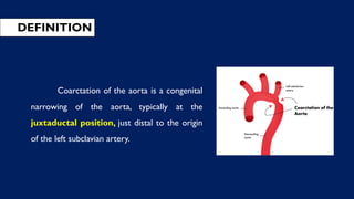 DEFINITION
Coarctation of the aorta is a congenital
narrowing of the aorta, typically at the
juxtaductal position, just distal to the origin
of the left subclavian artery.
 