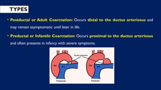 TYPES
• Postductal or Adult Coarctation: Occurs distal to the ductus arteriosus and
may remain asymptomatic until later in life.
• Preductal or Infantile Coarctation: Occurs proximal to the ductus arteriosus
and often presents in infancy with severe symptoms.
 