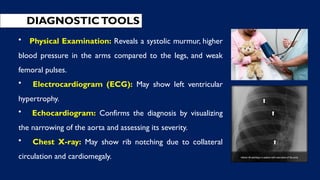 DIAGNOSTICTOOLS
• Physical Examination: Reveals a systolic murmur, higher
blood pressure in the arms compared to the legs, and weak
femoral pulses.
• Electrocardiogram (ECG): May show left ventricular
hypertrophy.
• Echocardiogram: Confirms the diagnosis by visualizing
the narrowing of the aorta and assessing its severity.
• Chest X-ray: May show rib notching due to collateral
circulation and cardiomegaly.
 