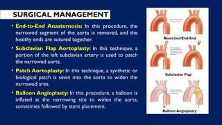 • End-to-End Anastomosis: In this procedure, the
narrowed segment of the aorta is removed, and the
healthy ends are sutured together.
• Subclavian Flap Aortoplasty: In this technique, a
portion of the left subclavian artery is used to patch
the narrowed aorta.
• Patch Aortoplasty: In this technique, a synthetic or
biological patch is sewn into the aorta to widen the
narrowed area.
• Balloon Angioplasty: In this procedure, a balloon is
inflated at the narrowing site to widen the aorta,
sometimes followed by stent placement.
SURGICAL MANAGEMENT
Resection/End-End
Subclavian Flap
Balloon Angioplasty
 