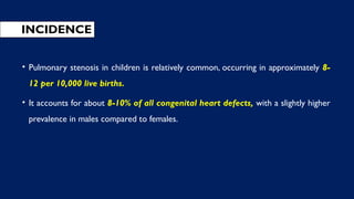 INCIDENCE
• Pulmonary stenosis in children is relatively common, occurring in approximately 8-
12 per 10,000 live births.
• It accounts for about 8-10% of all congenital heart defects, with a slightly higher
prevalence in males compared to females.
 