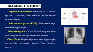 DIAGNOSTICTOOLS
• Physical Examination: Detection of a systolic
ejection murmur, often heard at the left second
intercostal space.
• Electrocardiogram (ECG): May reveal right
ventricular hypertrophy.
• Echocardiogram: Crucial for evaluating the valve
anatomy, gradient, and right ventricular function.
• Chest X-ray: Displays right ventricular hypertrophy
and possible post-stenotic dilation of the pulmonary
artery.
 