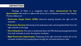 DEFINITION
Tetralogy of Fallot is a congenital heart defect characterized by four
abnormalities that result in a right-to-left shunt and is considered a cyanotic heart disease.
The four defects are:
• Ventricular Septal Defect (VSD): Abnormal opening between the right and left
ventricles.
• Pulmonary Stenosis: Narrowing of the pulmonary valve, restricting blood flow from the
right ventricle to the lungs.
• Overriding Aorta: The aorta is positioned above the VSD, allowing deoxygenated blood
from both ventricles to enter the systemic circulation.
• Right Ventricular Hypertrophy: Thickening of the right ventricular muscle due to the
increased workload from pumping blood through the narrowed pulmonary valve.
 