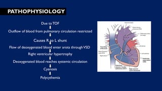 PATHOPHYSIOLOGY
Due toTOF
Outflow of blood from pulmonary circulation restricted
Causes R to L shunt
Flow of deoxygenated blood enter arota throughVSD
Right ventricular hypertrophy
Deoxygenated blood reaches systemic circulation
Cyanosis
Polycythemia
 