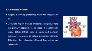 b. Complete Repair:
• Surgery is typically performed within the first year of
life.
• Complete Repair involves intracardiac surgery, where
the primary approach is to close the ventricular
septal defect (VSD) using a patch and perform
pulmonary valvotomy to relieve pulmonary stenosis.
This allows for redirection of blood flow to improve
oxygenation.
 