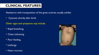 CLINICAL FEATURES
Newborns with transposition of the great arteries usually exhibit
• Cyanosis shortly after birth.
Other signs and symptoms may include
• Rapid breathing,
• Chest indrawing
• Poor feeding,
• Lethargy
• Heart murmur.
 